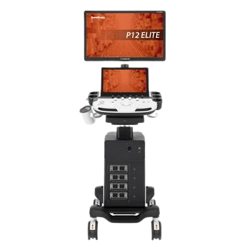 Sonoscape P12 Elite